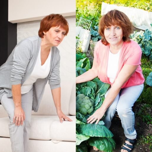 Milena: upognjena kolena so se po 4 tednih normalizirala