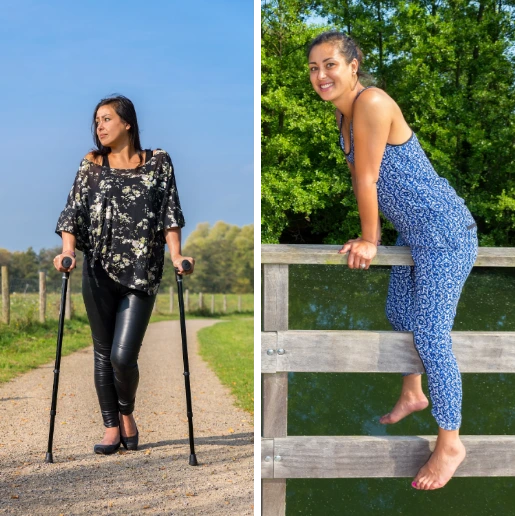 Marta z Jaworzna: nie ma już problemów z dysplazją biodra