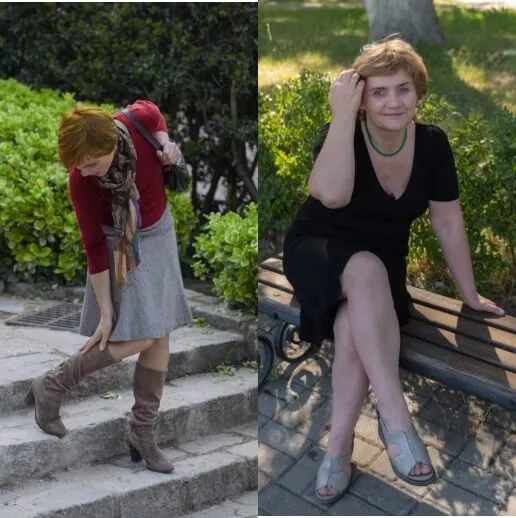 Marica: si è liberata del gonfiore e delle vene blu che ricoprivano le sue gambe 