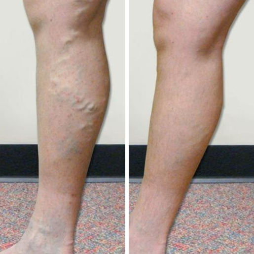 Efekty uzyskane przez Martynę z Gliwic