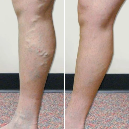 Effekter som uppnåtts av Maria från Oskarshamn